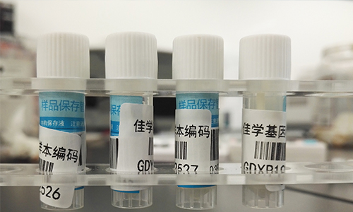 【佳學基因檢測】做Bosch-Boonstra-Schaaf視神經萎縮綜合征基因解碼、<a href=http://m.sushiinoueharlem.com/tk/jiema/cexujishu/2021/31933.html>基因檢測</a>需要多長時間？