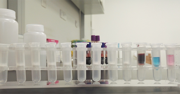 【佳學(xué)基因檢測(cè)】Brown-Vialetto-VanLaere綜合征2型基因解碼、<a href=http://m.sushiinoueharlem.com/tk/jiema/cexujishu/2021/31933.html>基因檢測(cè)</a>報(bào)告看得懂嗎？