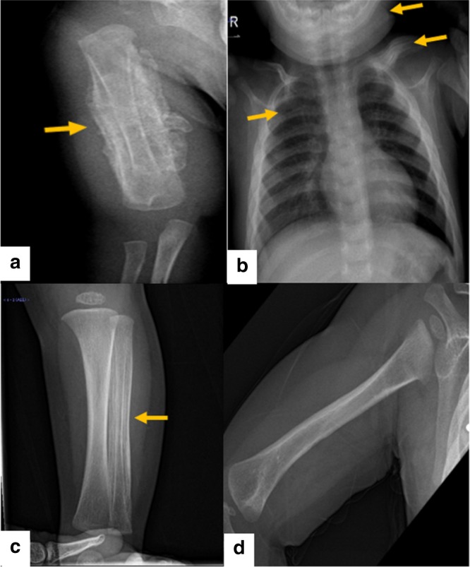 An external file that holds a picture, illustration, etc.
Object name is 41390_2019_499_Fig1_HTML.jpg