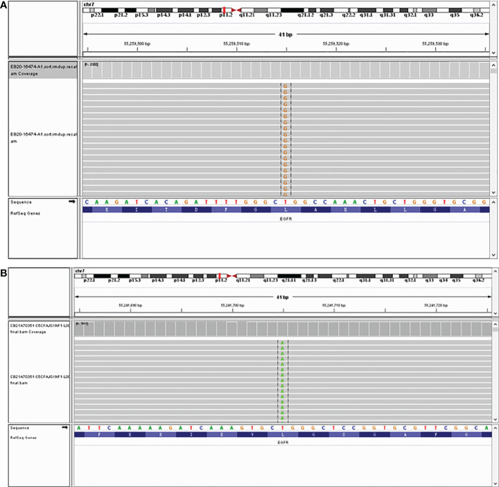 An external file that holds a picture, illustration, etc.
Object name is fonc-12-995624-g002.jpg