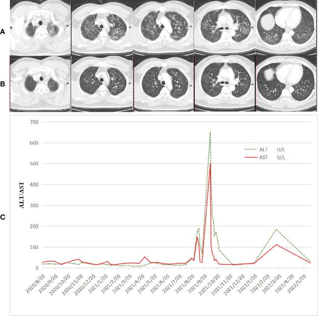 An external file that holds a picture, illustration, etc.
Object name is fimmu-13-1049518-g002.jpg