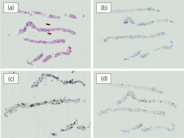 An external file that holds a picture, illustration, etc.
Object name is IJU5-6-37-g004.jpg