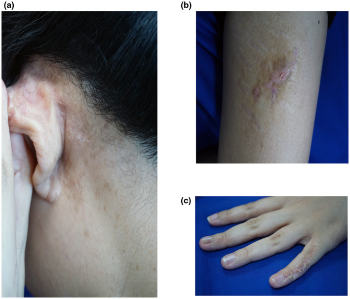 An external file that holds a picture, illustration, etc.
Object name is MGG3-10-e1848-g001.jpg