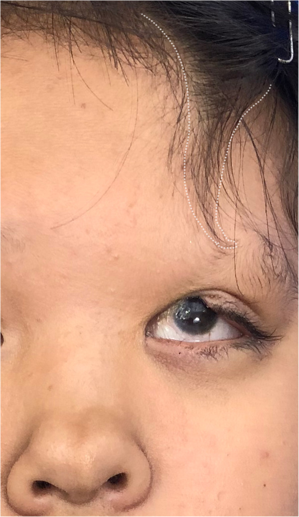 An external file that holds a picture, illustration, etc.
Object name is 12887_2021_2506_Fig1_HTML.jpg