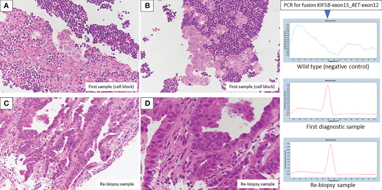 An external file that holds a picture, illustration, etc.
Object name is fonc-12-1019932-g003.jpg