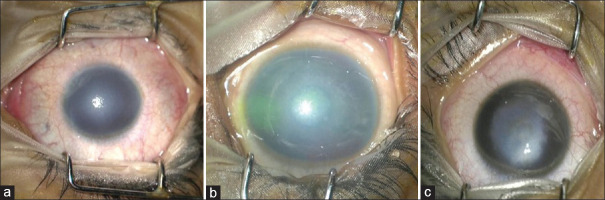 An external file that holds a picture, illustration, etc.
Object name is TJO-13-505-g002.jpg